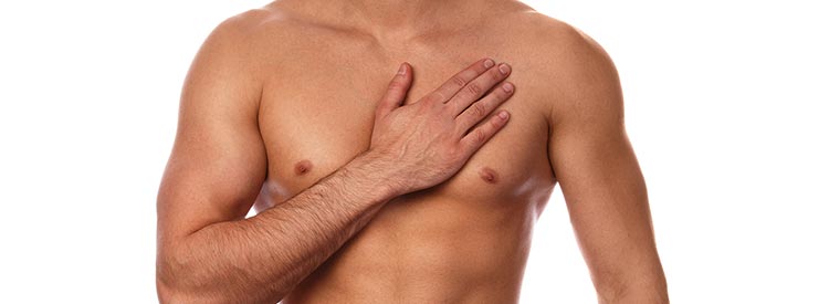 male breast reduction (gynaecomastia) - image 001